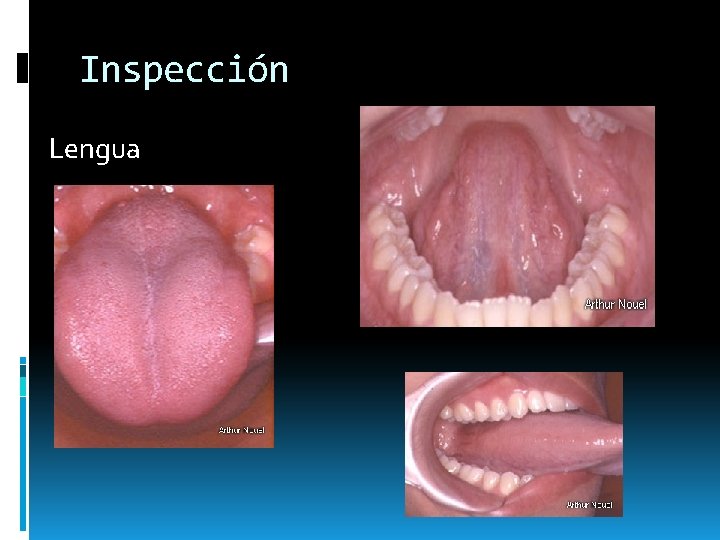 Inspección Lengua Inspección Lengua