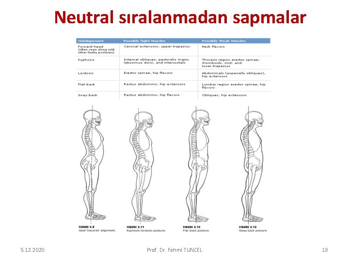 Neutral sıralanmadan sapmalar 5. 12. 2020 Prof. Dr. Fehmi TUNCEL 18 