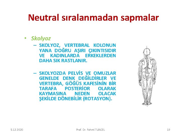 Neutral sıralanmadan sapmalar • Skolyoz – SKOLYOZ, VERTEBRAL KOLONUN YANA DOĞRU AŞIRI ÇIKINTISIDIR VE