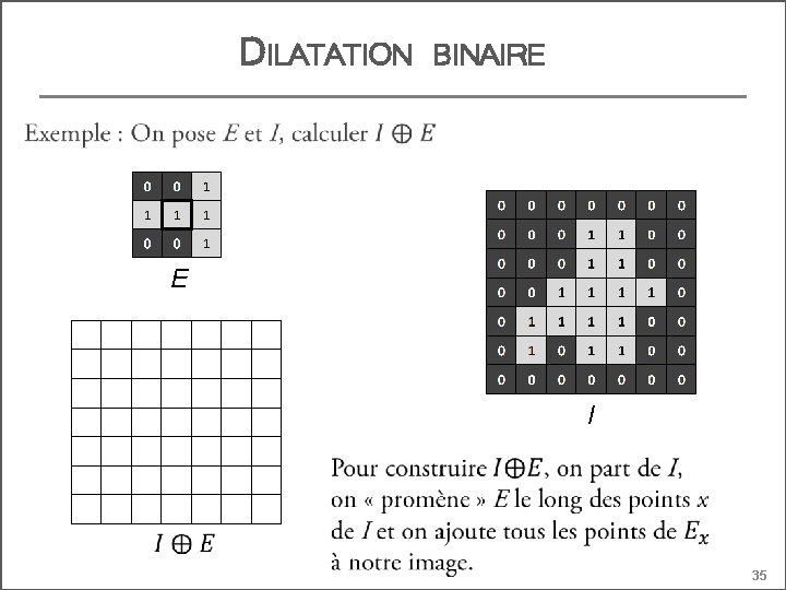 DILATATION BINAIRE E I 35 
