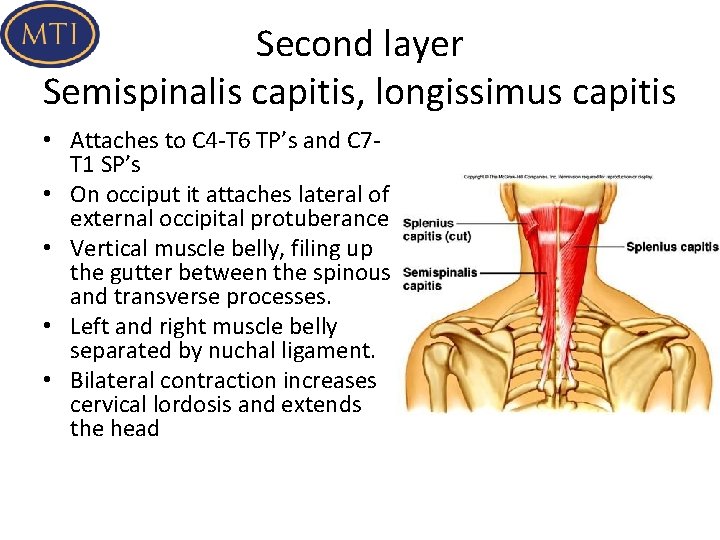 Second layer Semispinalis capitis, longissimus capitis • Attaches to C 4 -T 6 TP’s