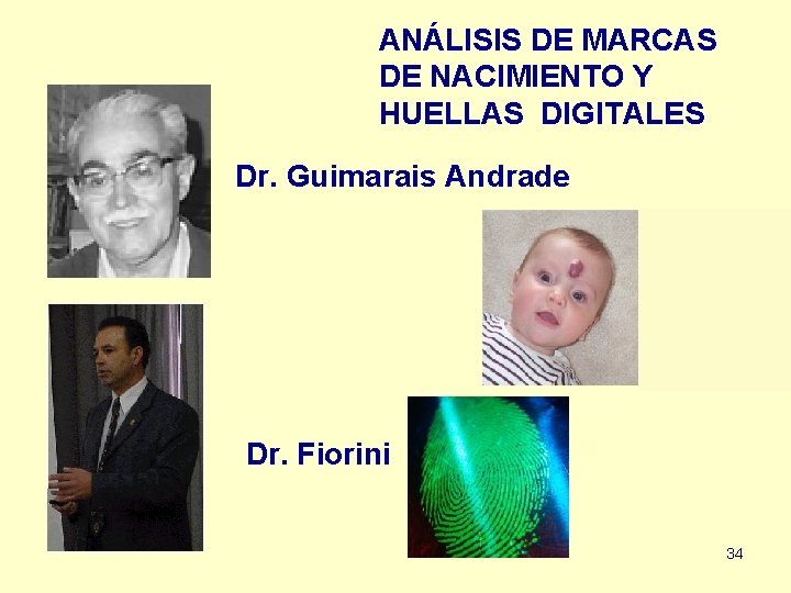 ANÁLISIS DE MARCAS DE NACIMIENTO Y HUELLAS DIGITALES Dr. Guimarais Andrade Dr. Fiorini 34