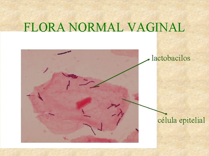 FLORA NORMAL VAGINAL lactobacilos célula epitelial 