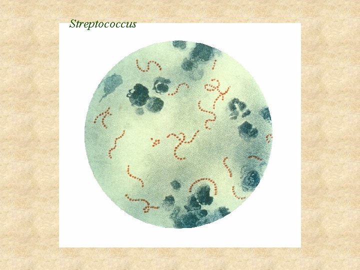 Streptococcus 