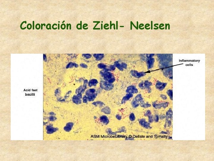 Coloración de Ziehl- Neelsen 