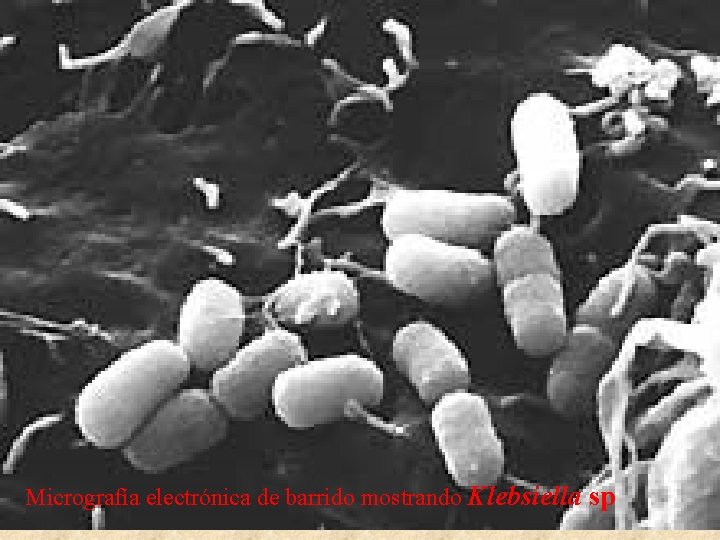 Micrografía electrónica de barrido mostrando Klebsiella sp 