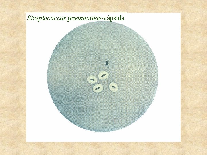 Streptococcus pneumoniae-cápsula 