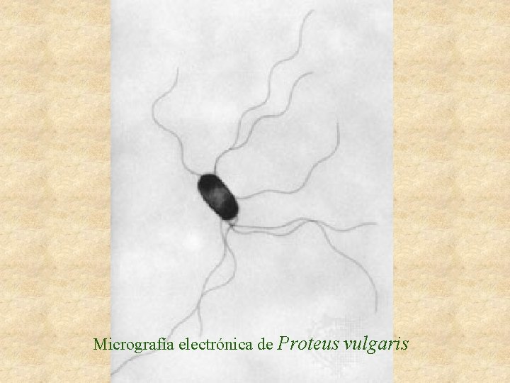 Micrografía electrónica de Proteus vulgaris 