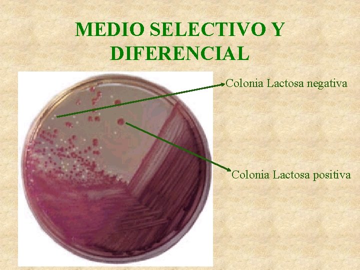 MEDIO SELECTIVO Y DIFERENCIAL Colonia Lactosa negativa Colonia Lactosa positiva 