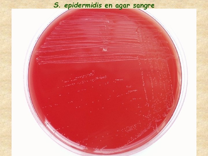 S. epidermidis en agar sangre 