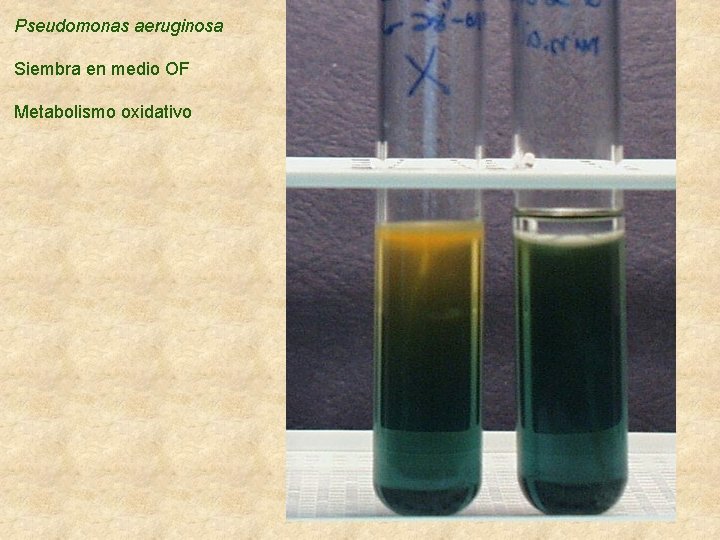 Pseudomonas aeruginosa Siembra en medio OF Metabolismo oxidativo 