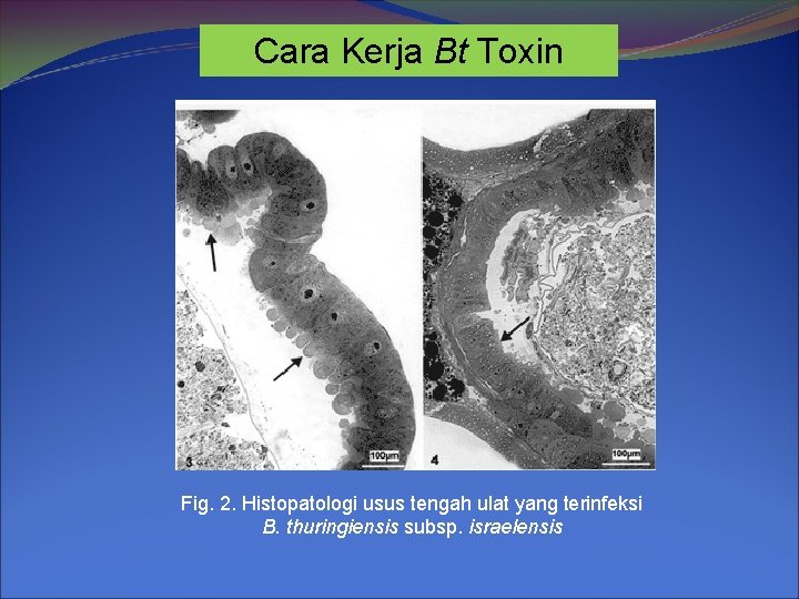Cara Kerja Bt Toxin Fig. 2. Histopatologi usus tengah ulat yang terinfeksi B. thuringiensis