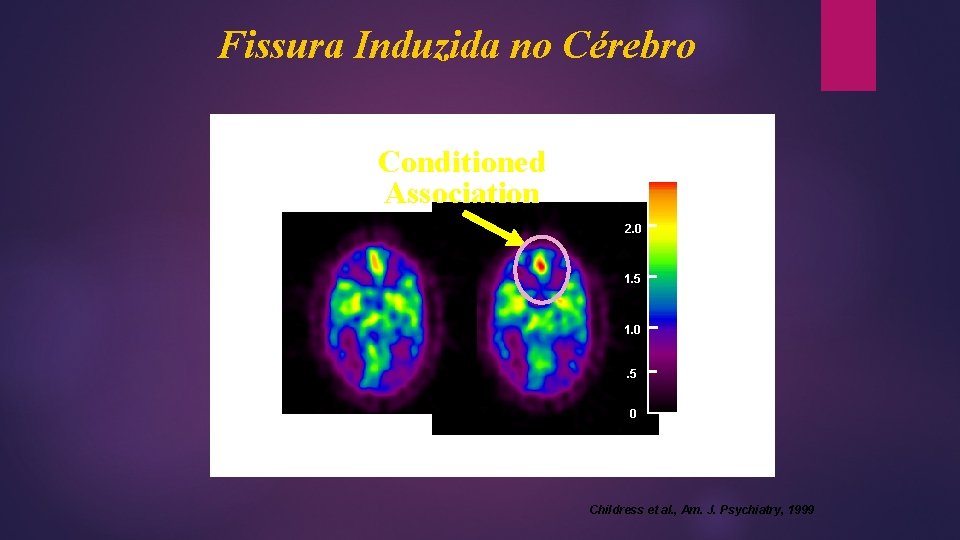 Fissura Induzida no Cérebro Conditioned Association 2. 5 2. 0 1. 5 1. 0 Fissura Induzida no Cérebro Conditioned Association 2. 5 2. 0 1. 5 1. 0