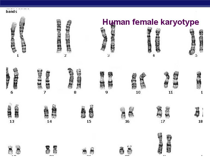 Human female karyotype AP Biology 