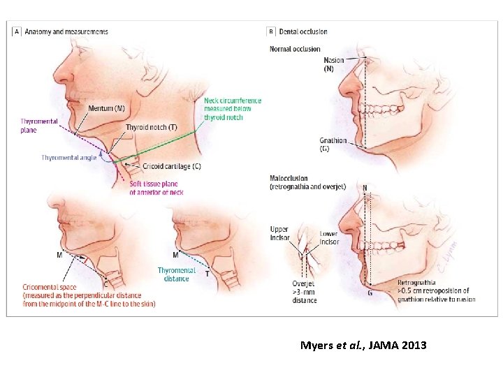 Myers et al. , JAMA 2013 