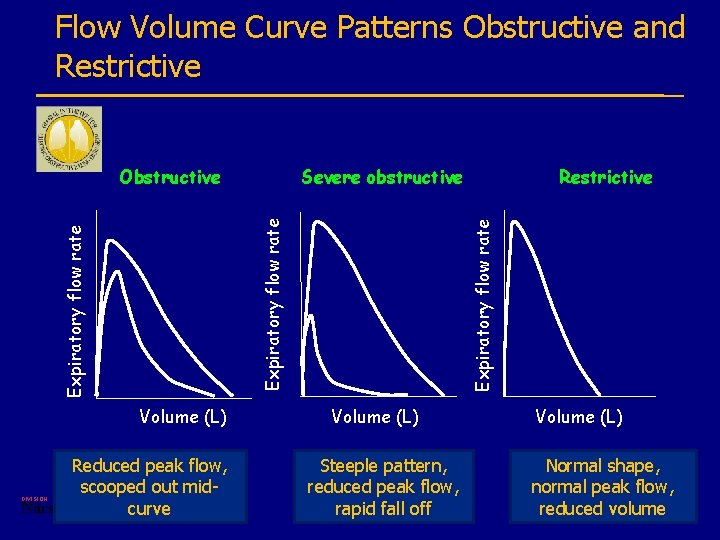 Flow Volume Curve Patterns Obstructive and Restrictive Reduced peak flow, scooped out mid. Närsjukvård