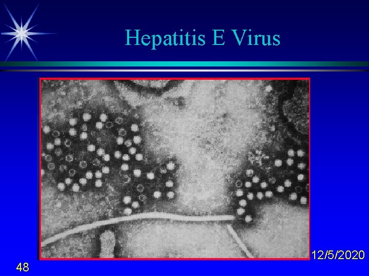 Hepatitis E Virus 48 12/5/2020 