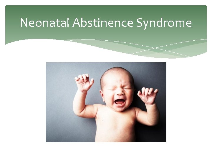 Neonatal Abstinence Syndrome 