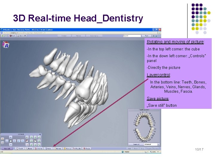 3 D Real-time Head_Dentistry Rotating and moving of picture: picture -In the top left