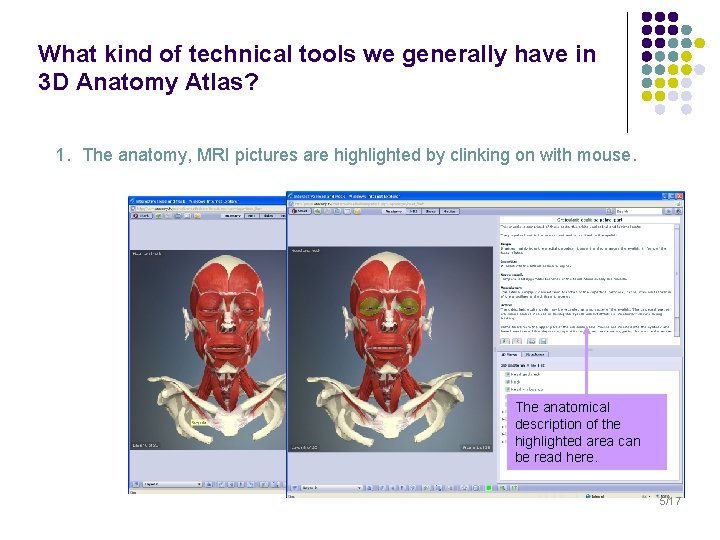 What kind of technical tools we generally have in 3 D Anatomy Atlas? 1.