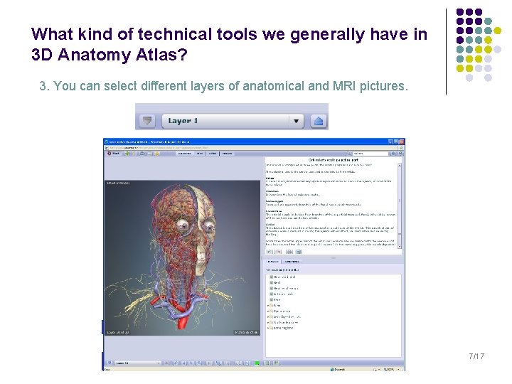 What kind of technical tools we generally have in 3 D Anatomy Atlas? 3.