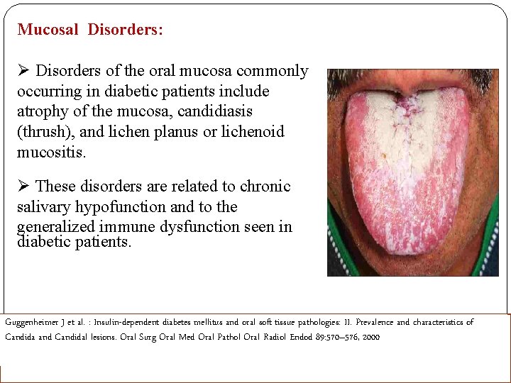 Mucosal Disorders: Ø Disorders of the oral mucosa commonly occurring in diabetic patients include