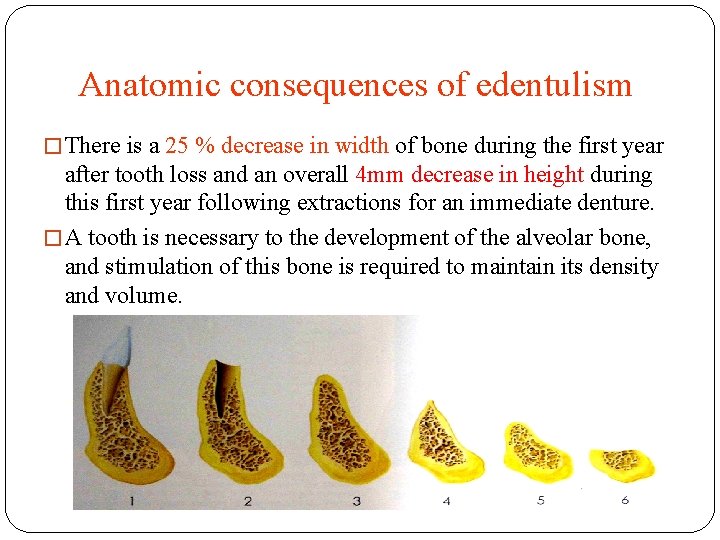 Anatomic consequences of edentulism � There is a 25 % decrease in width of