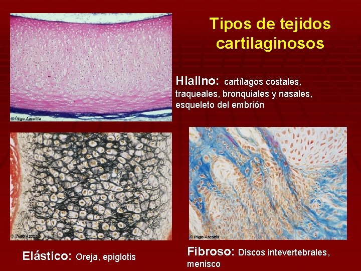 Tipos de tejidos cartilaginosos Hialino: cartílagos costales, traqueales, bronquiales y nasales, esqueleto del embrión