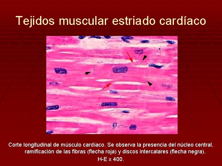 Tejidos muscular estriado cardíaco Corte longitudinal de músculo cardíaco. Se observa la presencia del