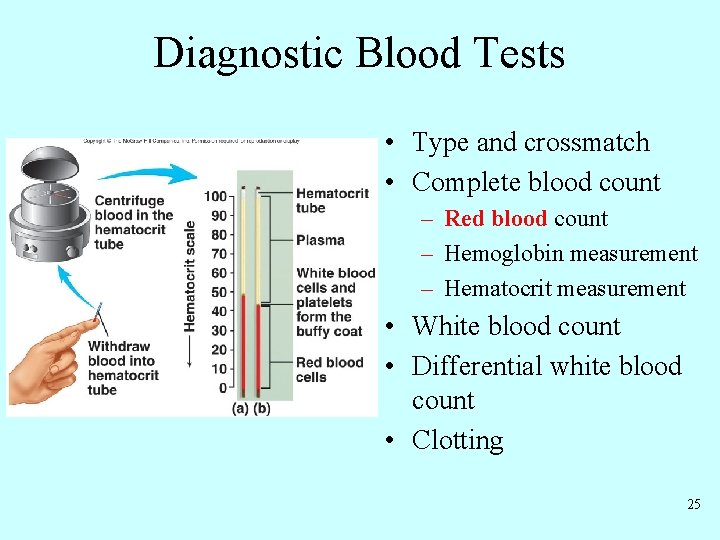 Diagnostic Blood Tests • Type and crossmatch • Complete blood count – Red blood