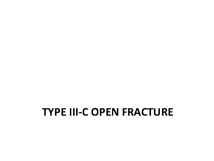 TYPE III-C OPEN FRACTURE 