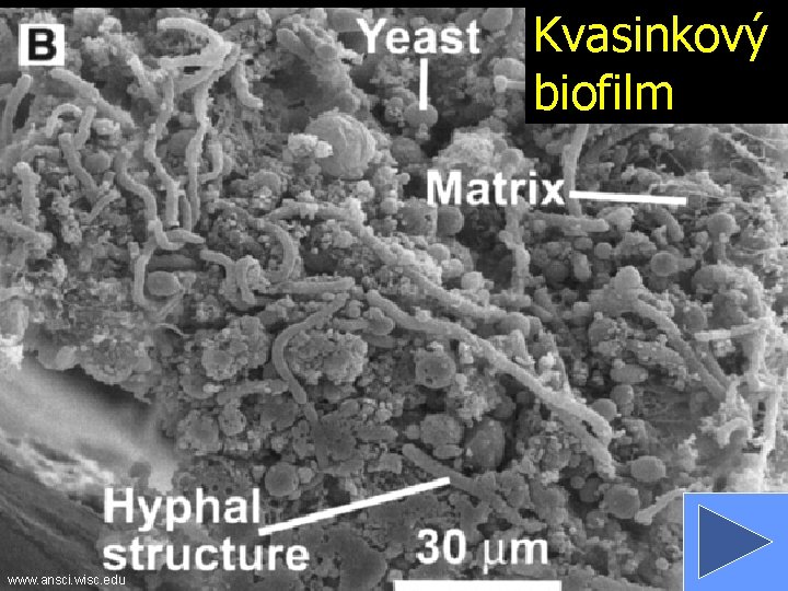 Kvasinkový biofilm www. ansci. wisc. edu 