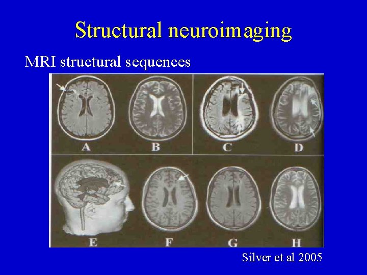 Structural neuroimaging MRI structural sequences Silver et al 2005 