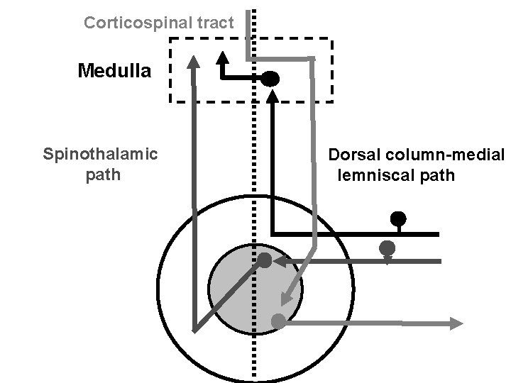 Corticospinal tract Medulla Spinothalamic path Dorsal column-medial lemniscal path 