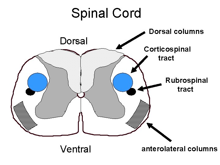 Spinal Cord Dorsal columns Dorsal Corticospinal tract Rubrospinal tract Ventral anterolateral columns 