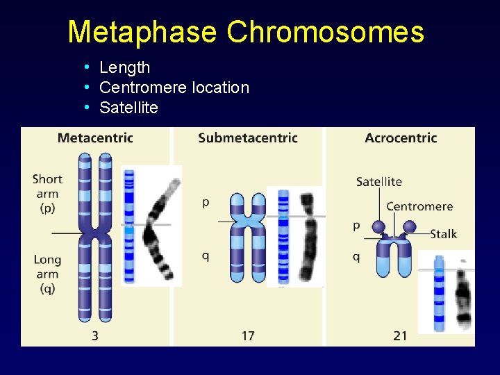 Metaphase Chromosomes • Length • Centromere location • Satellite 