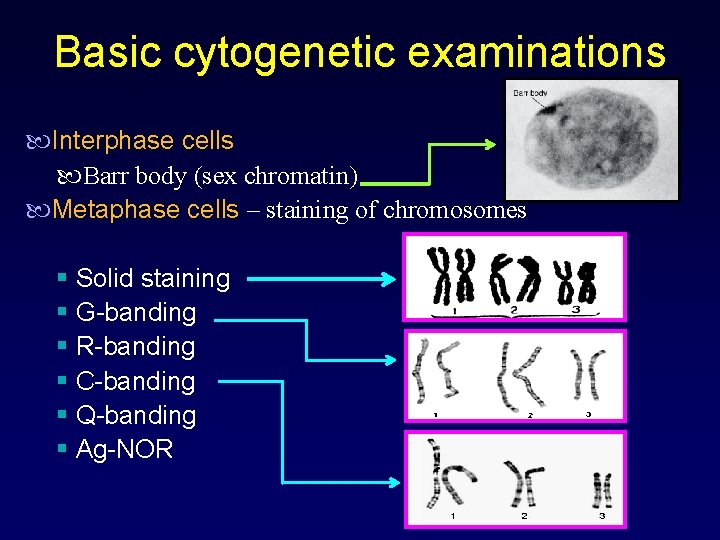 Basic cytogenetic examinations Interphase cells Barr body (sex chromatin) Metaphase cells – staining of