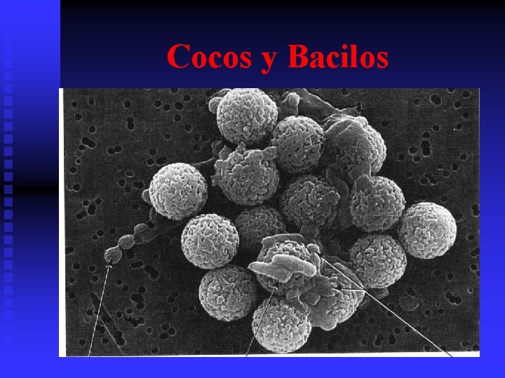 Cocos y Bacilos 