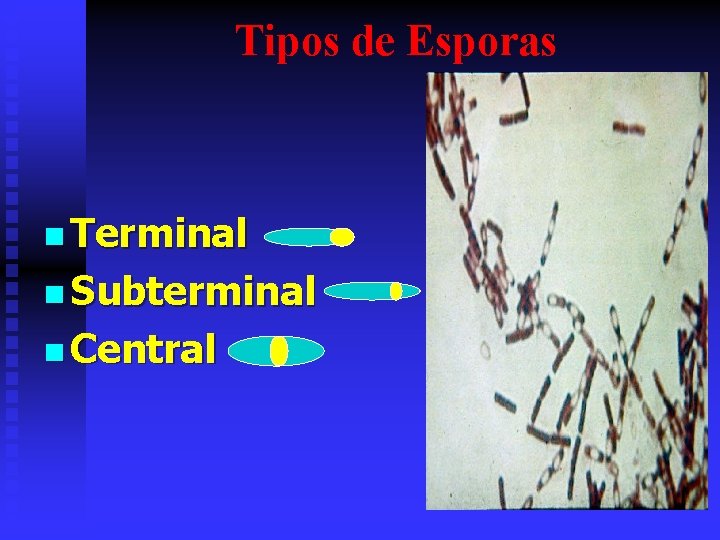 Tipos de Esporas n Terminal n Subterminal n Central 