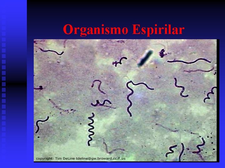 Organismo Espirilar 
