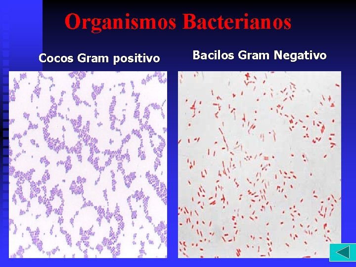 Organismos Bacterianos Cocos Gram positivo Bacilos Gram Negativo 