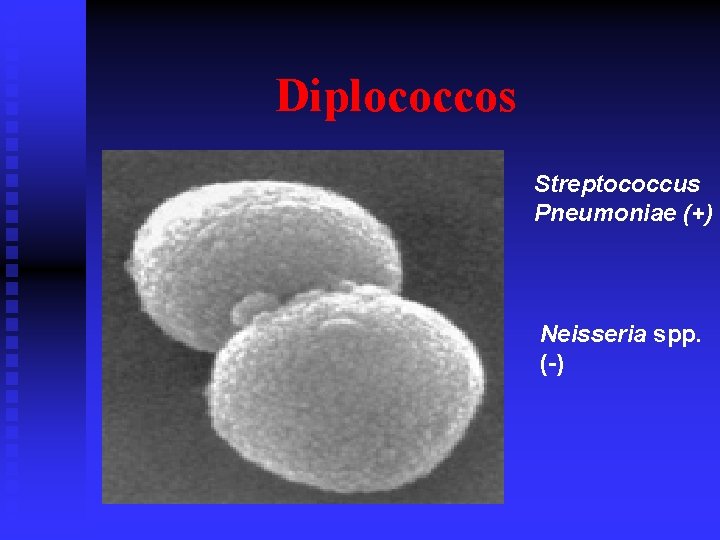 Diplococcos Streptococcus Pneumoniae (+) Neisseria spp. (-) 