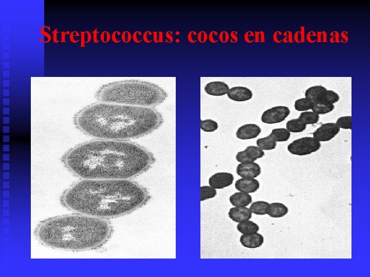 Streptococcus: cocos en cadenas 