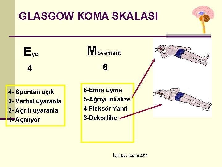 GLASGOW KOMA SKALASI Eye Movement 4 6 4 - Spontan açık 3 - Verbal