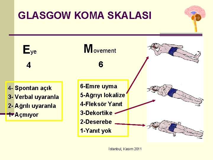 GLASGOW KOMA SKALASI Eye Movement 4 6 4 - Spontan açık 3 - Verbal