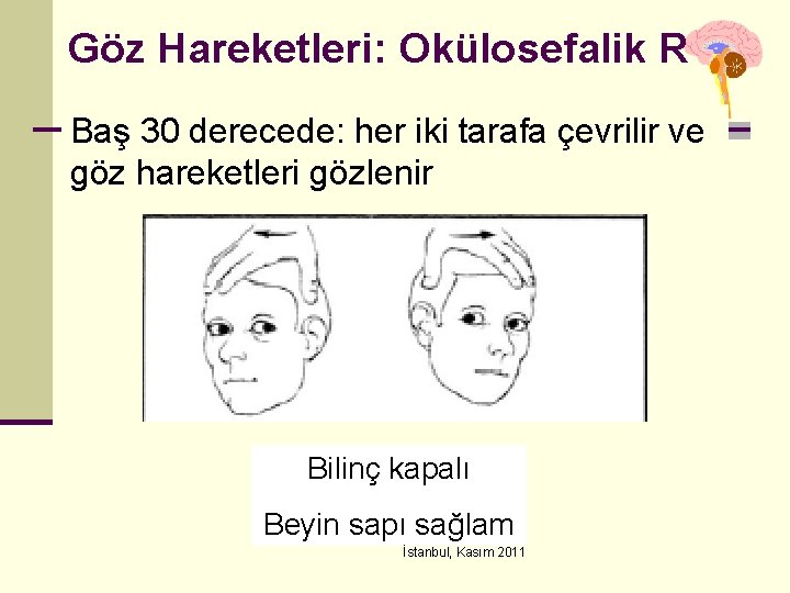 Göz Hareketleri: Okülosefalik R Baş 30 derecede: her iki tarafa çevrilir ve göz hareketleri