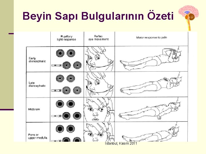 Beyin Sapı Bulgularının Özeti İstanbul, Kasım 2011 