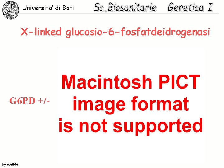 Universita’ di Bari X-linked glucosio-6 -fosfatdeidrogenasi G 6 PD +/- by GP&NA 