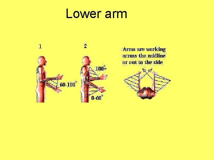 Lower arm 