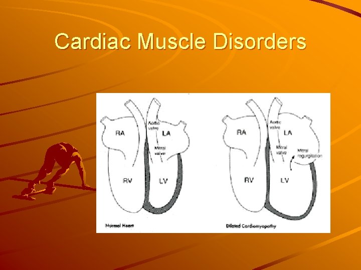 Cardiac Muscle Disorders 